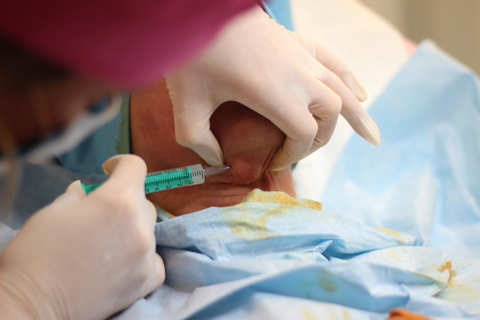 Injektionslipolyse (PPC)/Fettwegspritze Injektionslipolyse (PPC)/Fettwegspritze