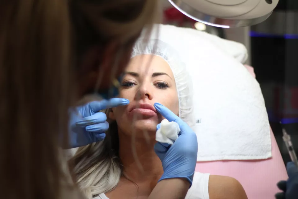 Filling with hyaluronic acid Filling with hyaluronic acid