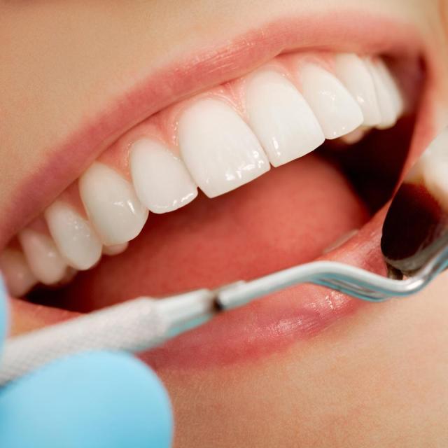 Dentální hygiena